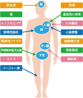 歯周病が原因となる疾患（一部）